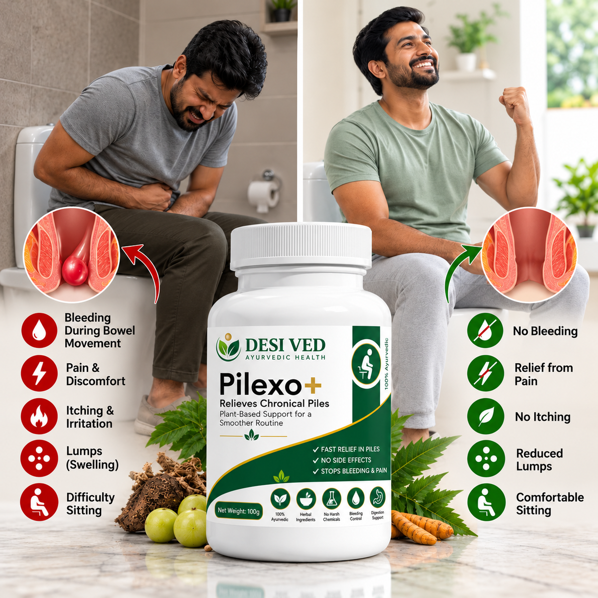 Desived Pilexo+ | Piles, Pain, Bleeding & Swelling Relief