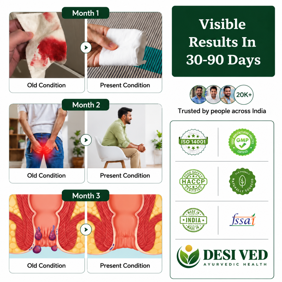 Desived Pilexo+ | Piles, Pain, Bleeding & Swelling Relief